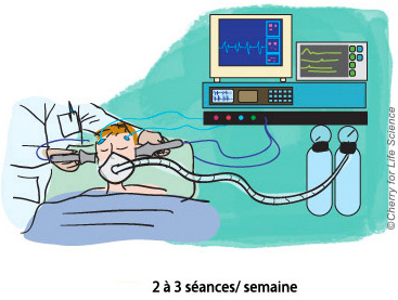 troubles bipolaires prise en charge du patient autres traitements trouble bipolaire sismotherapies